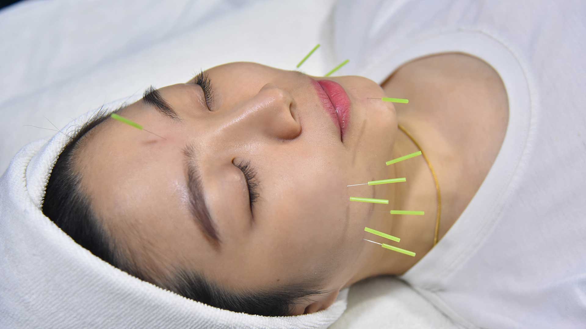 Explore acupuncture and other TCM therapies for targeted healing.